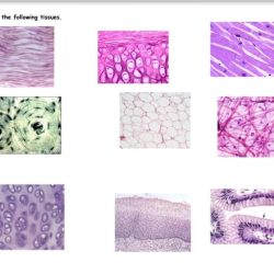 Identify each of the following tissues in figure 5.13